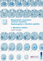 Magnetická rezonance nervové soustavy I. Radiologické a klinické aspekty. I, Mozkové nádory