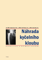 Náhrada kyčelního kloubu - rehabilitace a režimová opatření