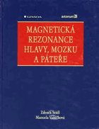 Magnetická rezonance hlavy, mozku a páteře