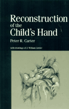 Reconstruction of the Child's Hand